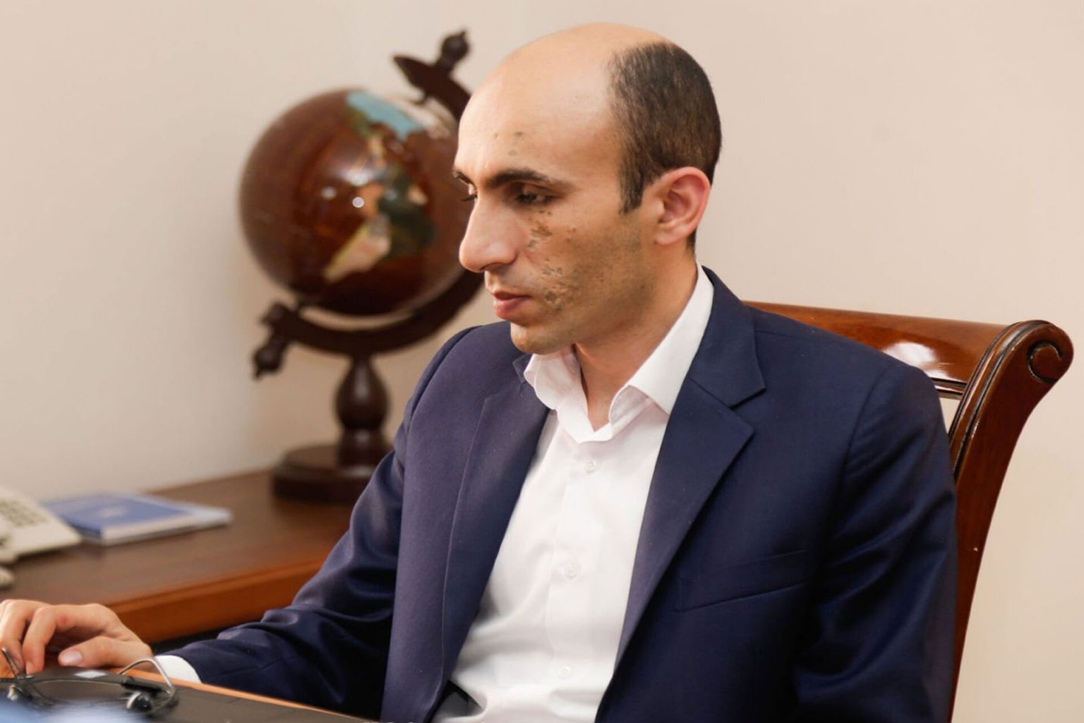 Շուկայական գների իրականությունը հաշվի չեն առել․ Արտակ Բեգլարյանը՝  բնակարանների համար արցախցիներին տրամադրվող գումարի մասին